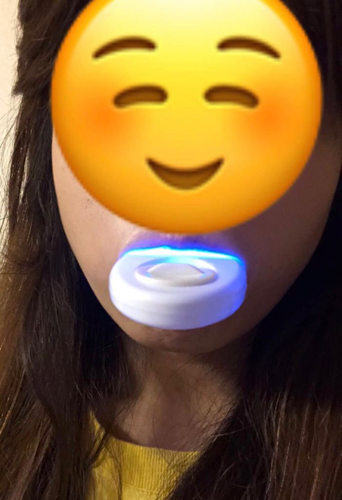 有效的LED藍光美白牙齒用後感??